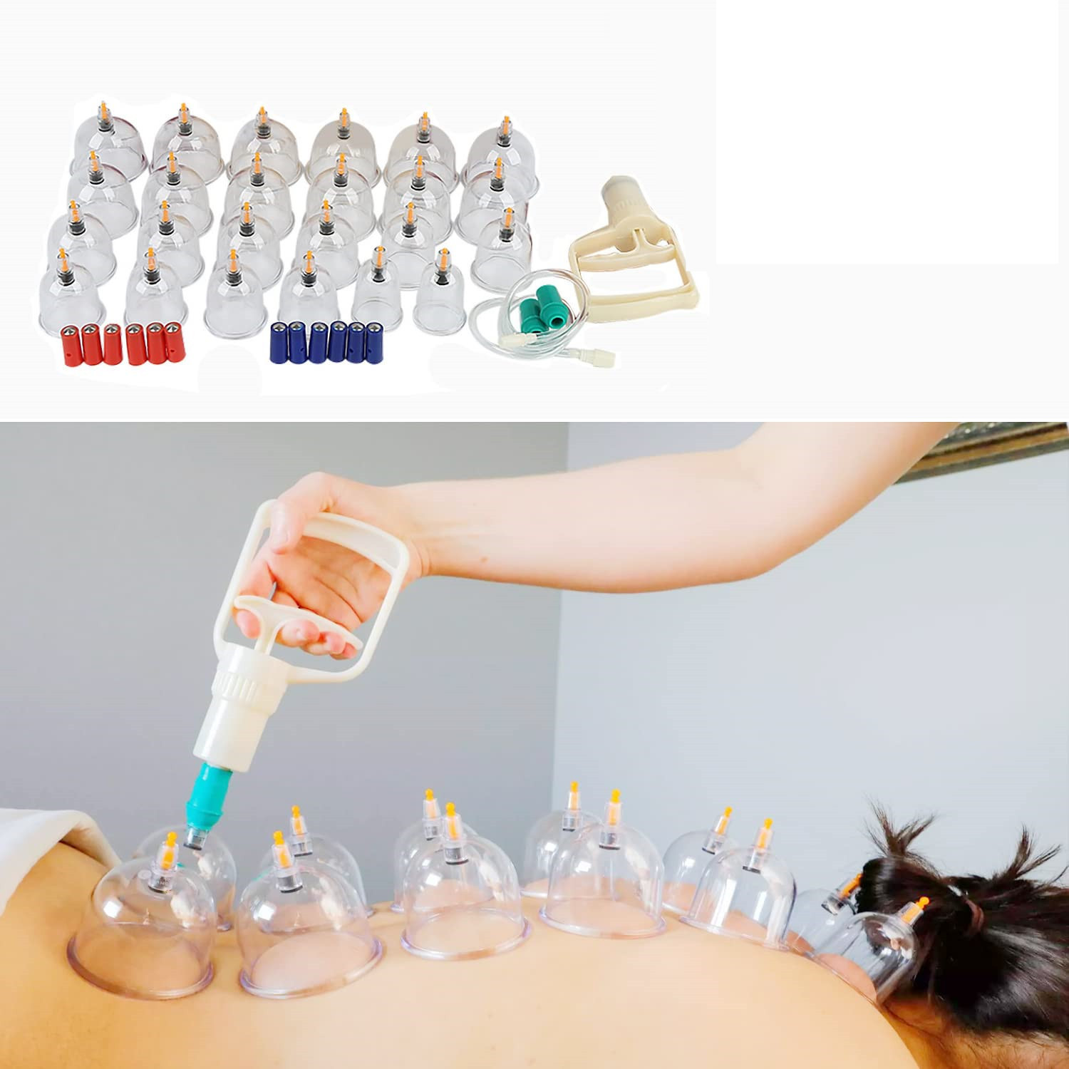 massage-cup-set-m-sugepumpe.jpg