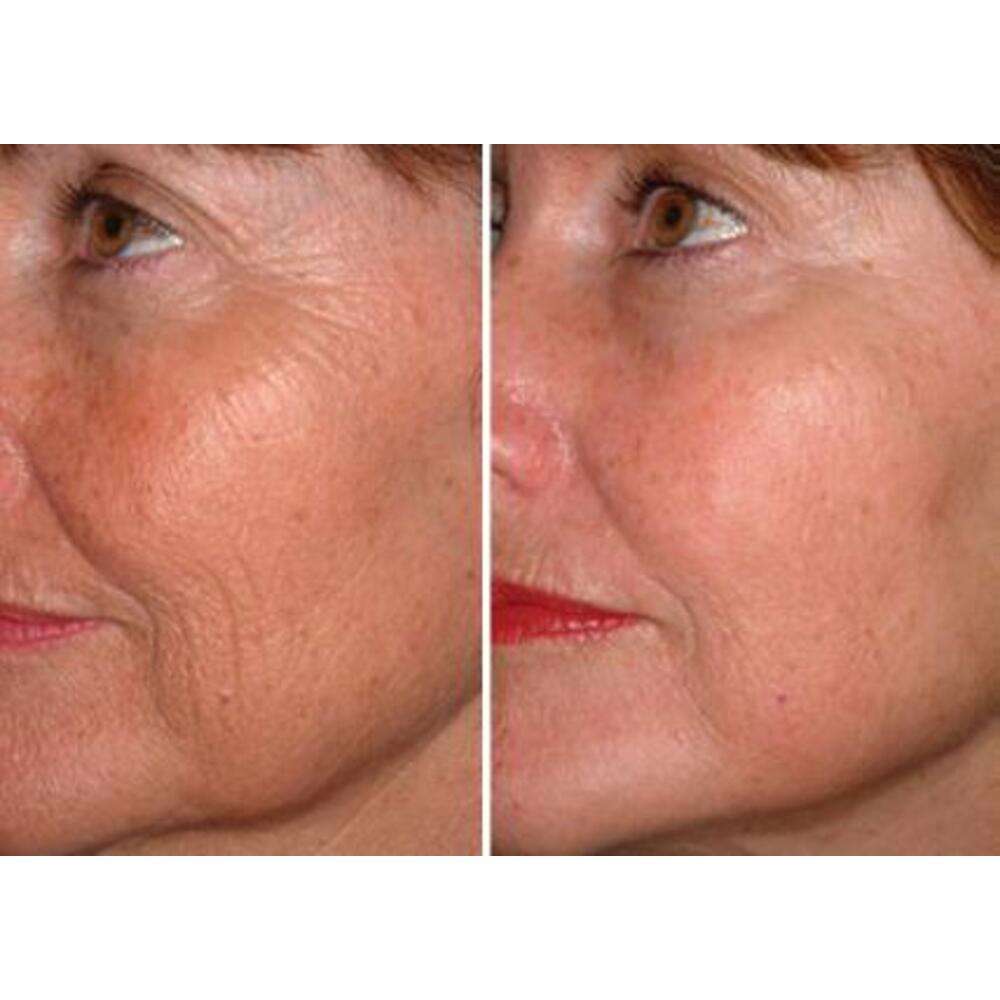 instantly-ageless-fra-juenesse-3-stk-.jpg