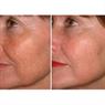 instantly-ageless-fra-juenesse-3-stk-.jpg